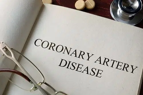 Coronary Artery Disease and SSA Disability Insurance