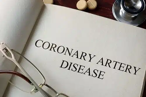 Coronary Artery Disease and SSA Disability Insurance 