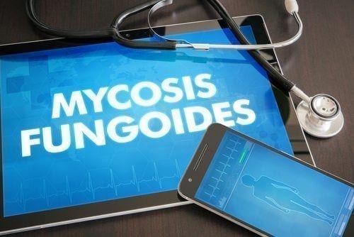 Social Security Disability for Mycosis Fungoides