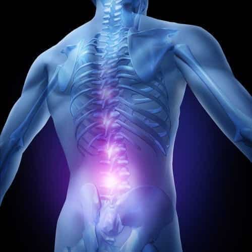 Lower Back Pain After Car Accident Compensation  