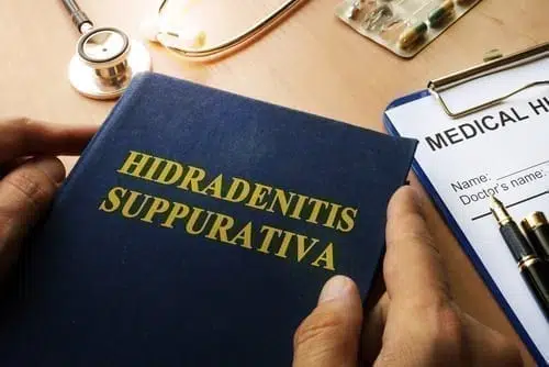 Social Security Disability for Hidradenitis suppurativa