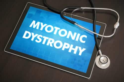 SSA Disability for Myotonic Dystrophy