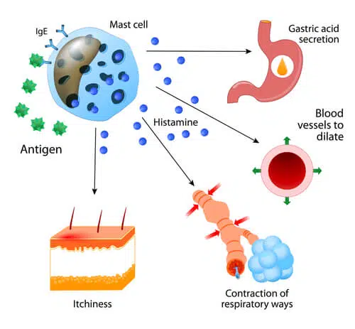 Mast Cell Activation Syndrome